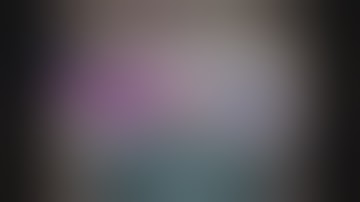 Trans Conjunctival SICS Sandwich Method