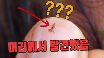 이(머릿니) 잡는 나뭇잎이 있다? 약으로 쓰는 방법ㅣ걸어다는건 처음 봄