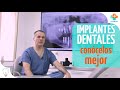 Implantes dentales  concelos mejor  tu salud gua