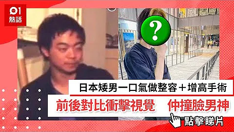 日本矮男一口气做整容＋增高手术　前后对比冲击视觉　仲撞脸男神 - 天天要闻