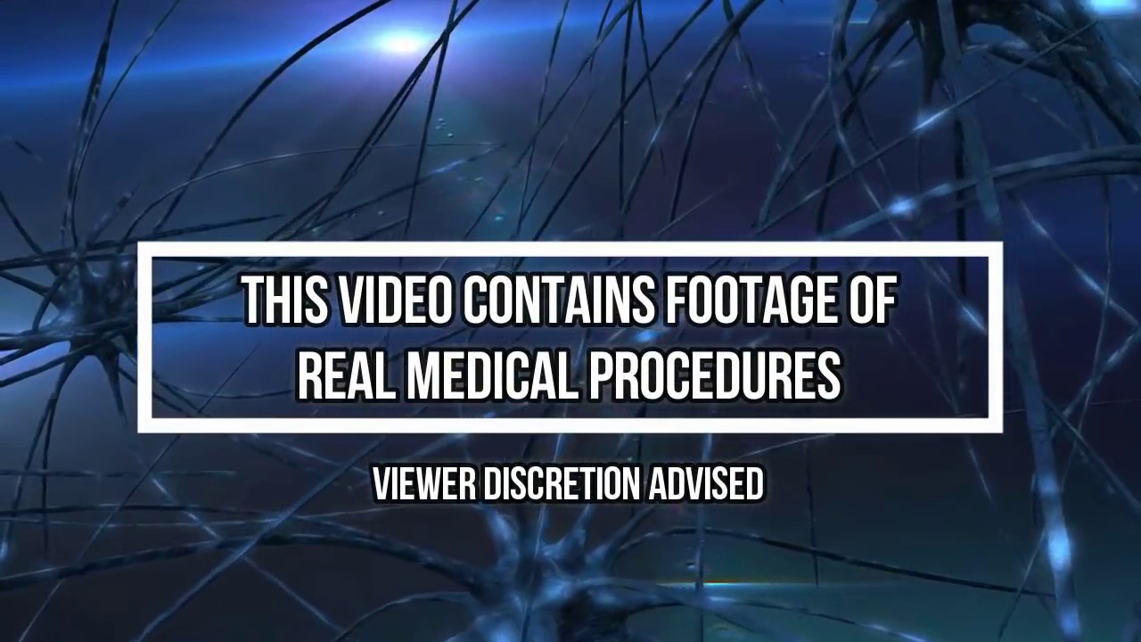 Knee Laceration Repair! Medical Monday 👍👍👍👍👍 YouTube