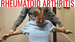Chiropractor Helps Rheumatoid Arthritic patient GET RID OF Neck, Shoulder, & Foot PAIN