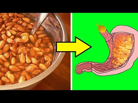 10 prohibited foods for gastritis, acidity, heartburn and gastroesophageal reflux