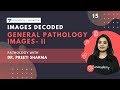 Images Decoded | Ep 15 | General Pathology Images- II | Dr. Preeti Sharma