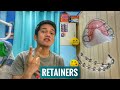 RETAINERS:Ano bang maganda?