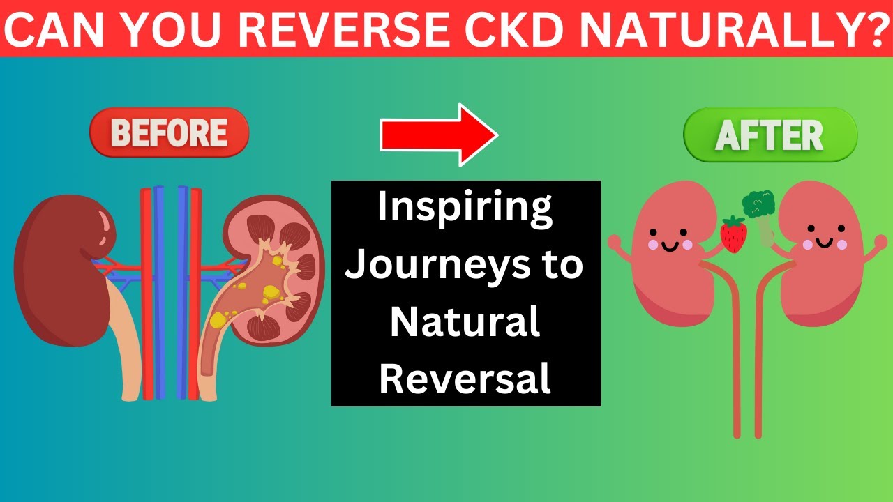 Success Stories: How People Reversed Chronic Kidney Disease Naturally