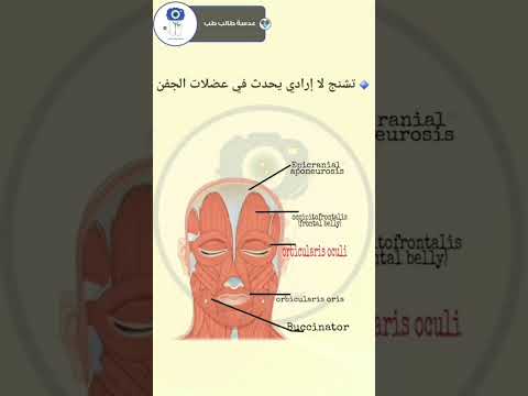 رعشة الجفن رفرفة الجفن الأسباب 