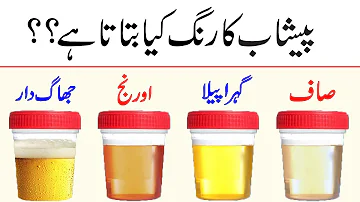 Urine Color Indications | Urine Color Meaning | Urine Colour | MedHealth Urdu