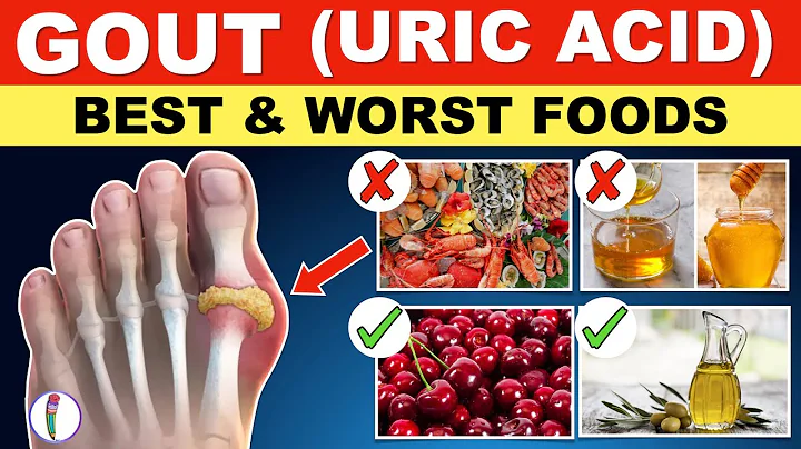 Uric acid Foods to Avoid | Gout Diet Meal Plan | Gout | Uric acid - Best & Worst Foods - DayDayNews