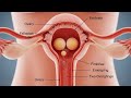 Twin Pregnancy Explained | Ovulation to Birth – Fertilization Process in 3D