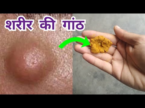 वीडियो: गिल्टहेड कैसे पकाने के लिए