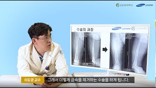 수술 동의서) 내고정기기 제거술