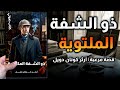 لغز الشفة الملتوية الجريمة الأكثر غرابة في ريف إنجلترا آرثر كونان دويل كتاب صوتي كامل