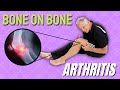 Bone on Bone Knee Arthritis and Pain: TOP 3 Things to Try.