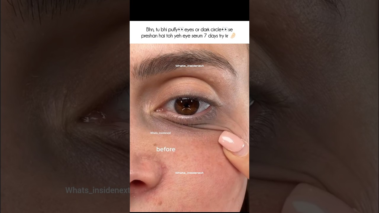Dark circle? 😱Use this viral serum#afufinds #skincare #eyes #fyp #viral #share #trending #darkcircle