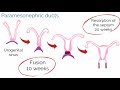 APGO Basic Sciences - Topic 20: Mullerian Anomalies