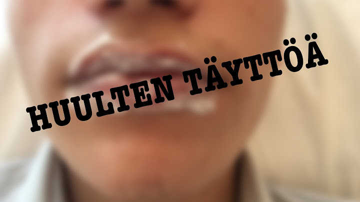 HUULIENTÄYTTÖ | TESTISSÄ