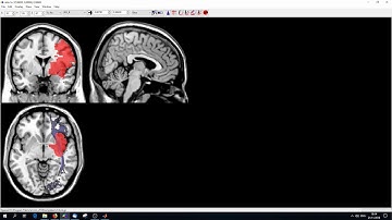 Methods in Neuropsychology Tübingen - Tutorial 3 Working with Brain Imaging in MATLAB/SPM