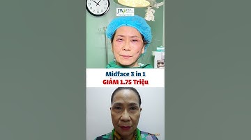 Bác sĩ Tú Dung trẻ hoá MIDFACE 3 IN 1 giúp Quý cô U60 cải lão hoàn đồng TRẺ 20 TUỔI
