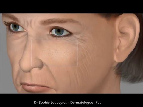 Traitement des pores