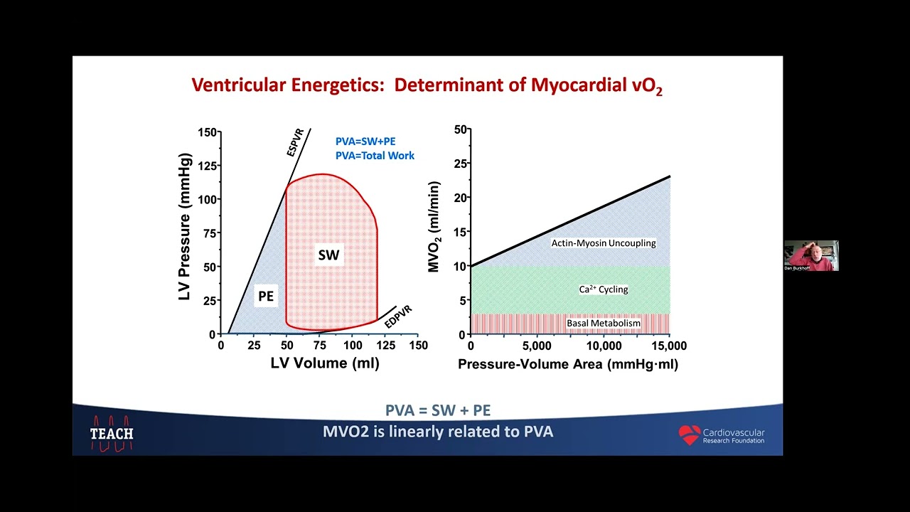 Cardiogenic Shock: Effect of different drugs and mechanical support devices. Dr Daniel Burkhoff