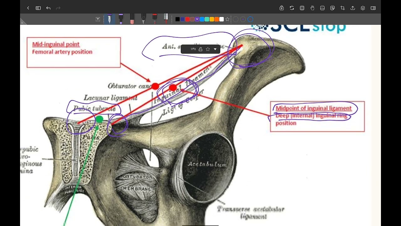 Mid Inguinal Line Anatomy
