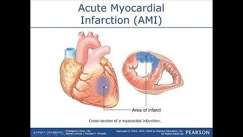 Cardiac Emergencies Lecture 3 / EMT MADE EASY