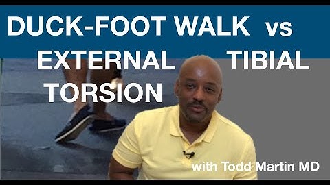 How to Fix Duck Feet vs External Tibial Torsion with Todd Martin MD
