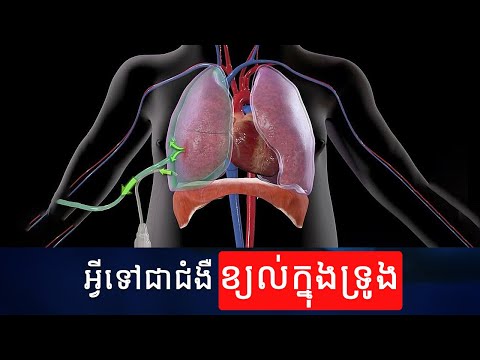 អ្វីទៅជាជំងឺខ្យល់ក្នុងទ្រូង | Pneumothorax