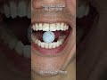 Satisfying Chewing ASMR #Compilation #ASMR #DoctorTristanPeh