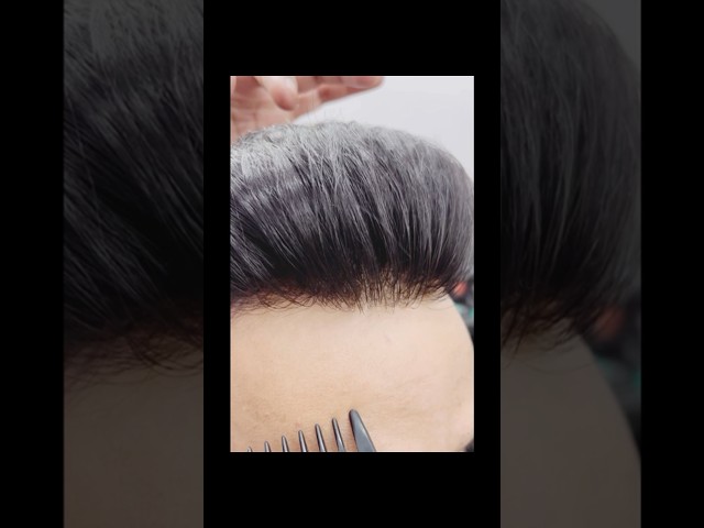 9899746489 amazing hair patch naturality in Delhi #reels #haircut #viral #explore #natural #results