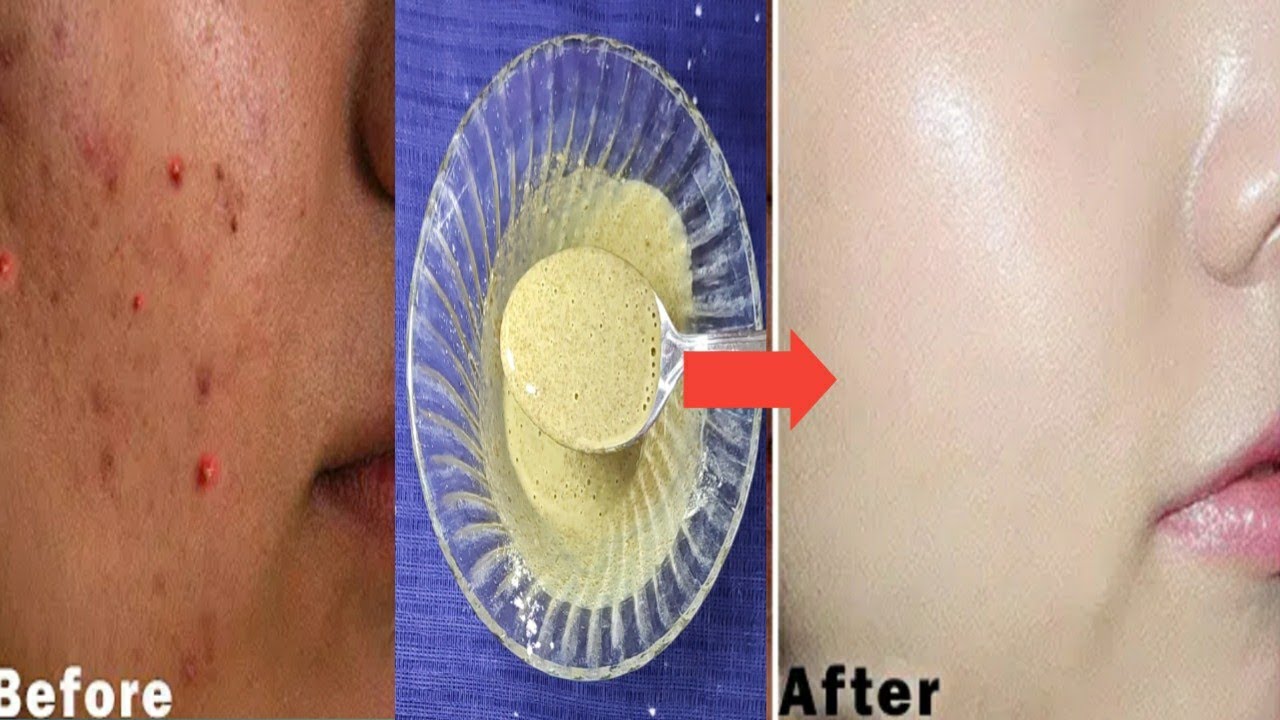 Download Corn Flour Acne Pimple Face Mask Pack Diy Youtube PSD Mockup Templates