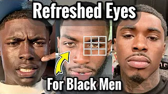 How to Get Rid of Eye Bags and Dark Circles for Black Men
