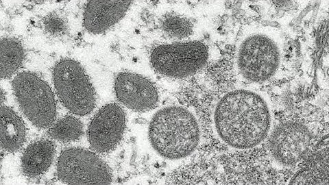 WHO declares monkeypox a global health emergency