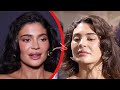 Top 10 Celebrities Who Destroyed Their Face With Plastic Surgery