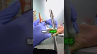 How to heal a trigger finger? #triggerfinger #painmanagement #painrelief
