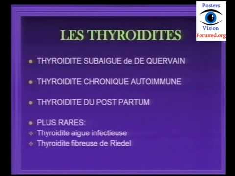 Vidéo: Thyroïdite Auto-immune - Traitement De La Thyroïdite Auto-immune Avec Des Remèdes Et Des Méthodes Populaires