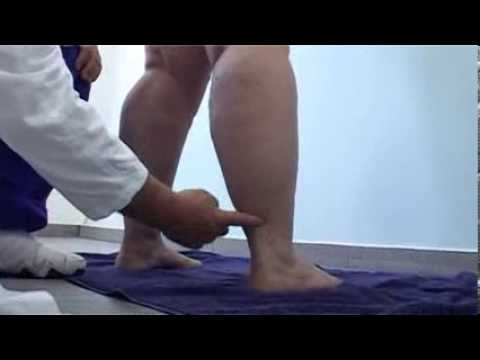 El lipedema se puede curar: el doctor M. E. Cornely nos presenta su método de intervención