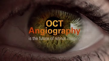 OCT Angiography (OCTA) by Optovue