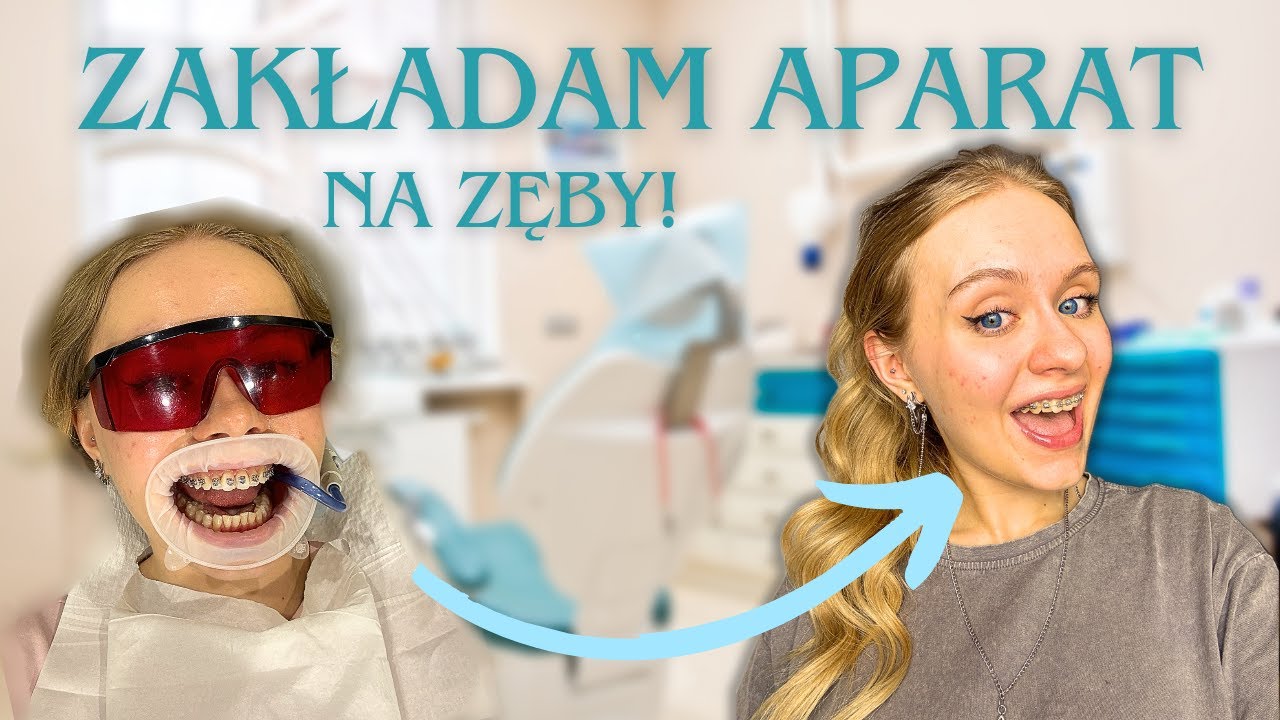 ZAKŁADAM APARAT ORTODONTYCZNY!