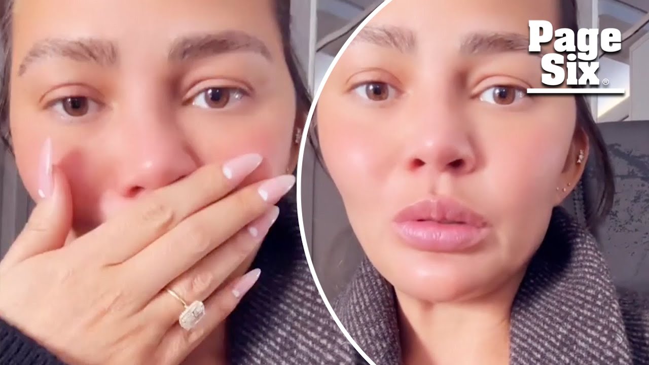 Chrissy Teigen describes ‘bracing for impact’ during plane’s ‘erroneous