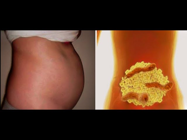 РАЗДУТЫЙ ЖИВОТ! Как избавиться от вздутия и похудеть ЗА НОЧЬ! Вот это поворот!