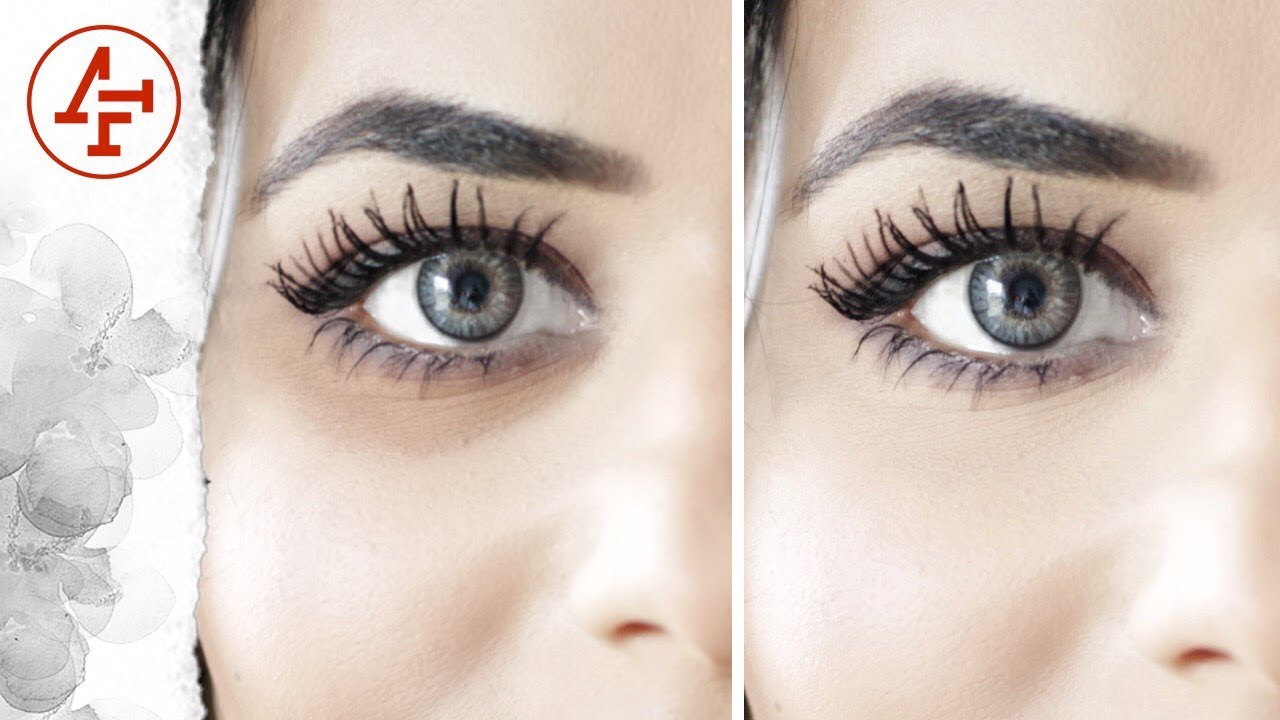 وصفه فعاله جدا للتخلص من الهالات السوداء - How to Remove Dark Circles