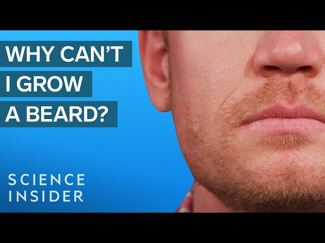 Why Some Men Can't Grow Beards class=