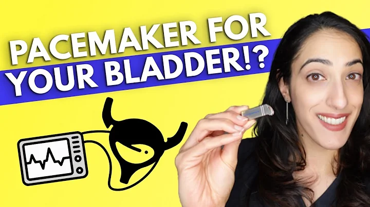 A pacemaker for your OVERACTIVE bladder?! | Everything YOU need to know