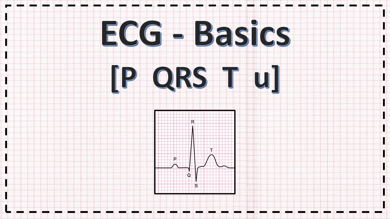 ecg hipertónia dekódolása