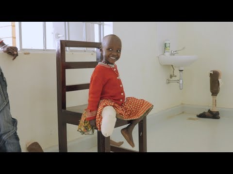 Revolutionizing Prosthetics, Redefining Disability