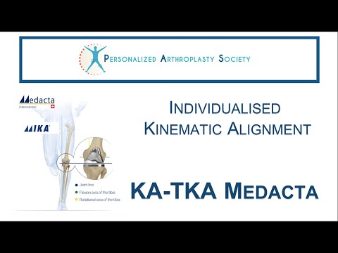 KA-TKA Medacta Individualised Kinematic Alignment