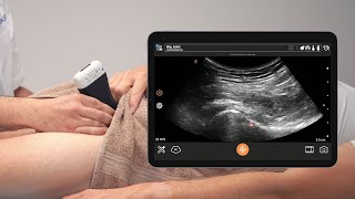 Ultrasound Examination of the Hip Joint