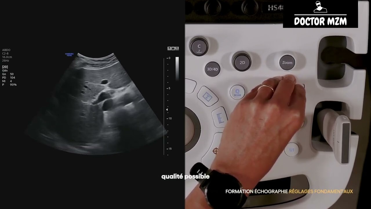 L'échographie 2D et les réglages fondamentaux | Formation en Échographie